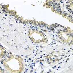 Anti-STXBP2 antibody used in IHC (Paraffin sections) (IHC-P). GTX33529