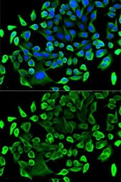 Anti-TAB1 antibody used in Immunocytochemistry/ Immunofluorescence (ICC/IF). GTX33533