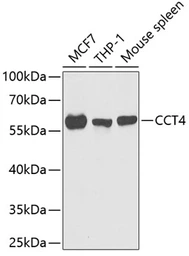 Anti-TCP1 delta antibody used in Western Blot (WB). GTX33536