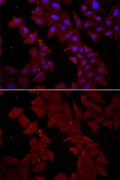 Anti-TCP1 delta antibody used in Immunocytochemistry/ Immunofluorescence (ICC/IF). GTX33536