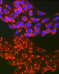 Anti-TFEB antibody used in Immunocytochemistry/ Immunofluorescence (ICC/IF). GTX33541
