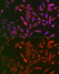 Anti-TNF Receptor I antibody used in Immunocytochemistry/ Immunofluorescence (ICC/IF). GTX33550