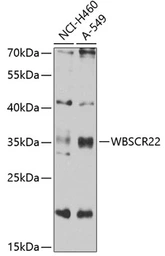 Anti-WBSCR22 antibody used in Western Blot (WB). GTX33582