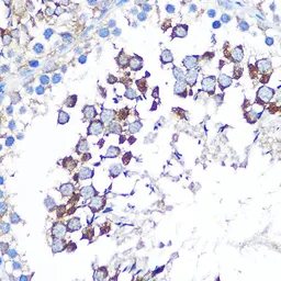 Anti-WISP2 antibody used in IHC (Paraffin sections) (IHC-P). GTX33585