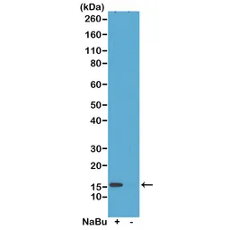 Anti-Histone H2A.Z (Acetyl Lys4) antibody [RM221] used in Western Blot (WB). GTX33591
