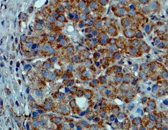 Anti-B-Raf (V600E Mutant Specific) antibody [RM8] used in IHC (Paraffin sections) (IHC-P). GTX33595
