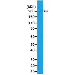 Anti-Acetyl-CoA Carboxylase 1 antibody [RM232] used in Western Blot (WB). GTX33608