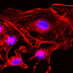 Anti-beta Actin antibody [RM112] used in Immunocytochemistry/ Immunofluorescence (ICC/IF). GTX33610