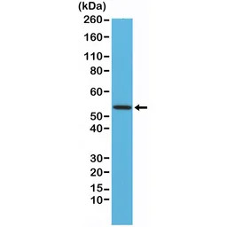 Anti-Desmin antibody [RM234] used in Western Blot (WB). GTX33613