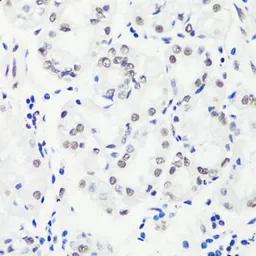 Anti-Histone H3R17me2 (Symmetric Di-methyl Arg17) antibody used in IHC (Paraffin sections) (IHC-P). GTX33907