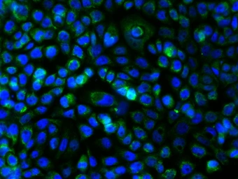 Anti-c-Kit antibody used in Immunocytochemistry/ Immunofluorescence (ICC/IF). GTX33947