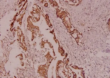 Anti-HSL antibody used in IHC (Paraffin sections) (IHC-P). GTX33956