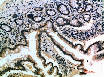 Anti-IL17B antibody used in IHC (Paraffin sections) (IHC-P). GTX34010