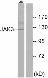 Anti-JAK3 antibody used in Western Blot (WB). GTX34020