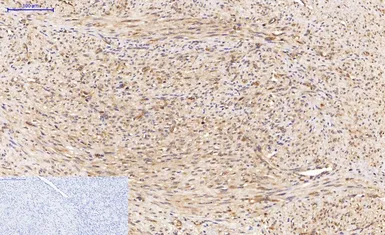 Anti-LC3A antibody [5G10] used in IHC (Paraffin sections) (IHC-P). GTX34067