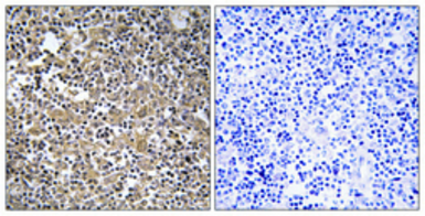 Anti-MAST205 antibody used in IHC (Paraffin sections) (IHC-P). GTX34072