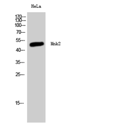 Anti-MNK2 antibody used in Western Blot (WB). GTX34078