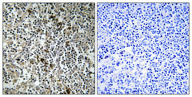 Anti-MRPL4 antibody used in IHC (Paraffin sections) (IHC-P). GTX34087
