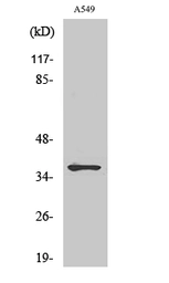 Anti-MT-ND1 antibody used in Western Blot (WB). GTX34092