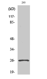 Anti-NRL antibody used in Western Blot (WB). GTX34102
