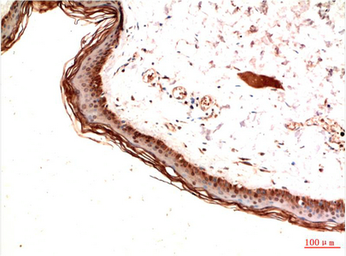 Anti-PDGF Receptor alpha antibody [7A3] used in IHC (Paraffin sections) (IHC-P). GTX34117