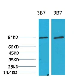 Anti-PI3 kinase p85 alpha antibody [3B7] used in Western Blot (WB). GTX34122