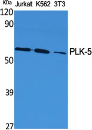 Anti-PLK5 antibody used in Western Blot (WB). GTX34126