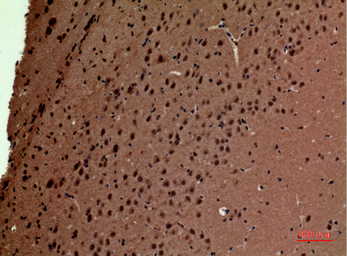 Anti-POLR3G antibody used in IHC (Paraffin sections) (IHC-P). GTX34131