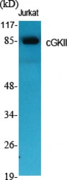 Anti-CGK2 antibody used in Western Blot (WB). GTX34144