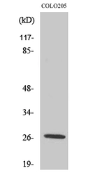 Anti-PRSS33 antibody used in Western Blot (WB). GTX34148