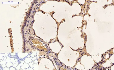 Anti-Caspase 9 antibody [3-20] used in IHC (Paraffin sections) (IHC-P). GTX34168