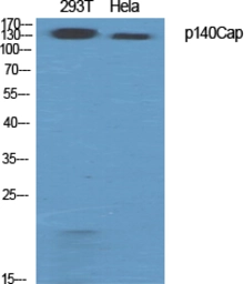Anti-SNIP / p140Cap antibody used in Western Blot (WB). GTX34226
