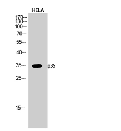 Anti-p35 antibody used in Western Blot (WB). GTX34250