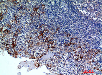 Anti-CMTM8 antibody used in IHC (Paraffin sections) (IHC-P). GTX34321