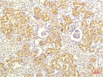 Anti-CXCL8 / IL8 antibody [13F8] used in IHC (Paraffin sections) (IHC-P). GTX34341