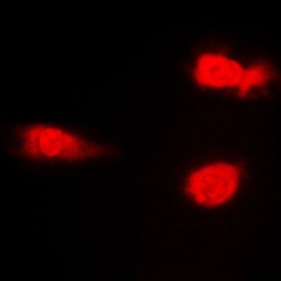 Anti-JNK (phospho Thr183) antibody used in Immunocytochemistry/ Immunofluorescence (ICC/IF). GTX34387
