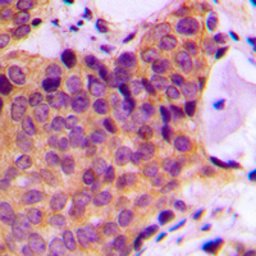 Anti-JNK (phospho Thr183) antibody used in IHC (Paraffin sections) (IHC-P). GTX34387