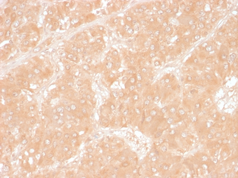 Anti-ADFP antibody [ADFP/1366] used in IHC (Paraffin sections) (IHC-P). GTX34396