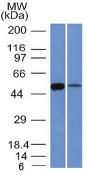 Anti-ALDH1A1 antibody [ALDH1A1/1381] used in Western Blot (WB). GTX34400