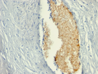 Anti-AMPD3 antibody [AMPD3/901] used in IHC (Paraffin sections) (IHC-P). GTX34411
