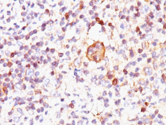 Anti-Bax antibody [2D2] used in IHC (Paraffin sections) (IHC-P). GTX34422