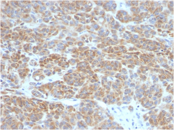 Anti-Bcl-2 antibody [BCL2/782] used in IHC (Paraffin sections) (IHC-P). GTX34429