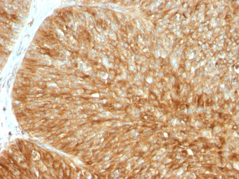 Anti-beta 2 Microglobulin antibody [B2M/961] used in IHC (Paraffin sections) (IHC-P). GTX34437