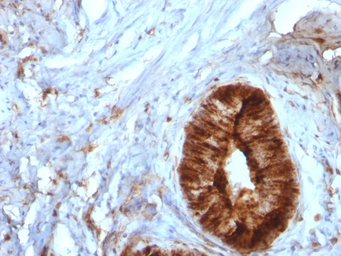 Anti-beta 2 Microglobulin antibody [B2M/961] used in IHC (Paraffin sections) (IHC-P). GTX34437