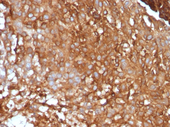 Anti-beta 2 Microglobulin antibody [B2M/961] used in IHC (Paraffin sections) (IHC-P). GTX34437