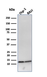 Anti-beta 2 Microglobulin antibody [B2M/961] used in Western Blot (WB). GTX34437