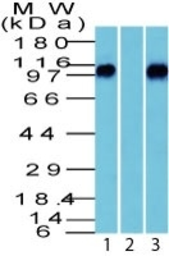 Anti-beta Catenin antibody used in Western Blot (WB). GTX34438