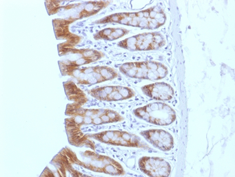 Anti-beta Catenin antibody [CTNNB1/1508] used in IHC (Paraffin sections) (IHC-P). GTX34443