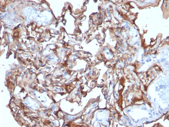 Anti-CD146 antibody [MCAM/1101] used in IHC (Paraffin sections) (IHC-P). GTX34458