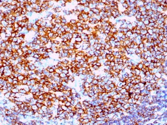 Anti-CD20 antibody [IGEL/1497R] used in IHC (Paraffin sections) (IHC-P). GTX34477